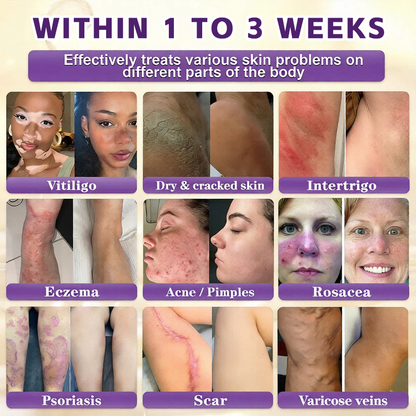 Deep Hydration Cream