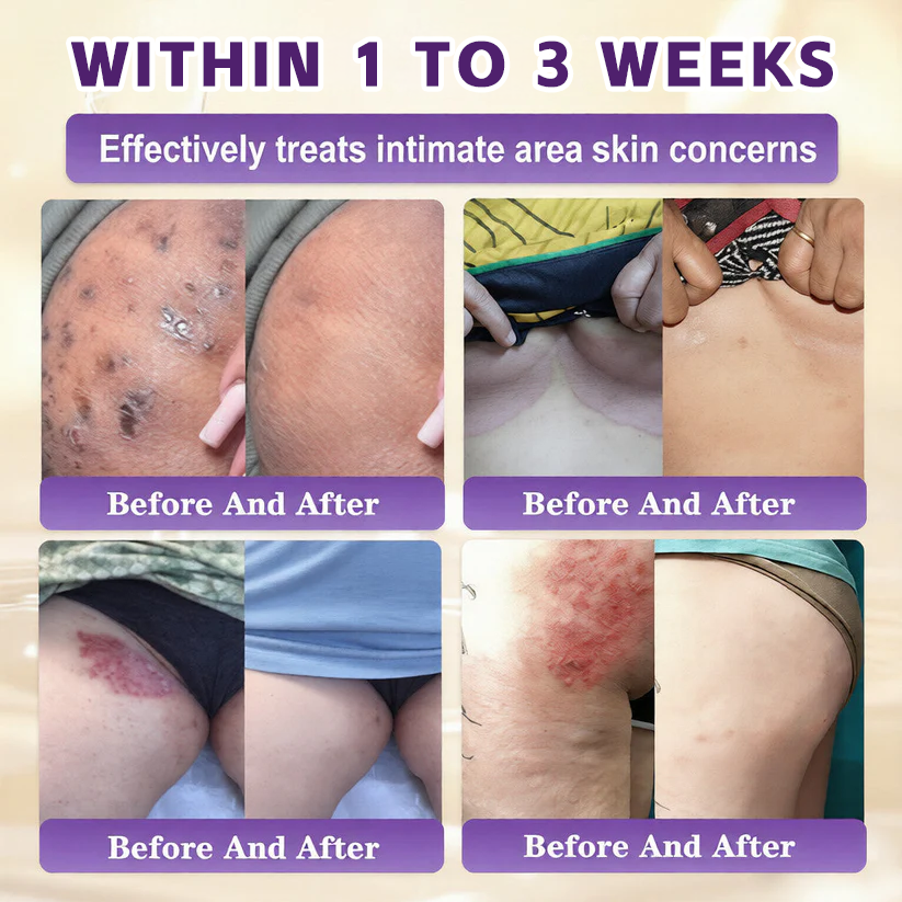 Deep Hydration Cream