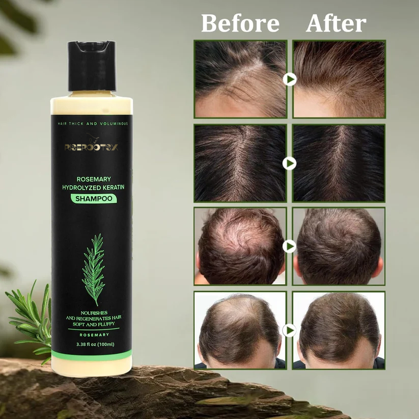 🔥LAST DAY 50% OFF - 🌿Riserootsx® Organic Rosemary Hair Growth Shampoo