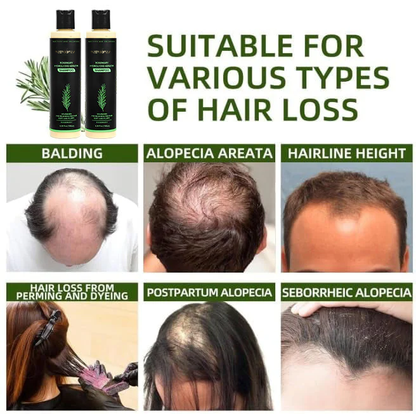 🔥LAST DAY 50% OFF - 🌿Riserootsx® Organic Rosemary Hair Growth Shampoo