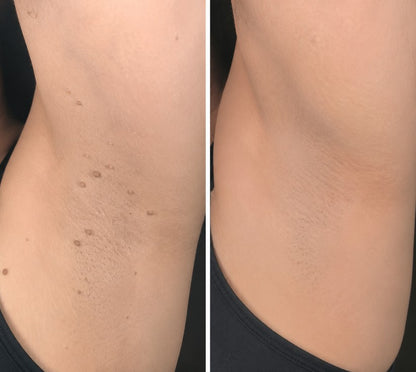 🌟Riserootsx® 2-in-1 Hydrocolloid Care Patches