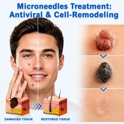 🌟Riserootsx® 2-in-1 Hydrocolloid Care Patches